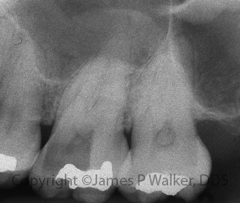 Molar