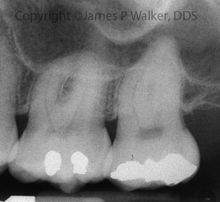 Preoperative view